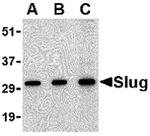 SLUG Antibody in Western Blot (WB)