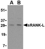 CD254 (RANK Ligand) Antibody in Western Blot (WB)