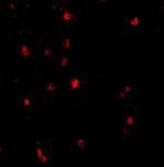 c-Cbl Antibody in Immunohistochemistry (IHC)