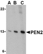 PEN2 Antibody in Western Blot (WB)