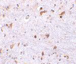 PDCD4 Antibody in Immunohistochemistry (IHC)