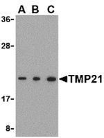 TMP21 Antibody in Western Blot (WB)