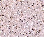 TMP21 Antibody in Immunohistochemistry (IHC)