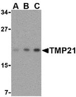 TMP21 Antibody in Western Blot (WB)