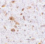 TSLP Antibody in Immunohistochemistry (Paraffin) (IHC (P))