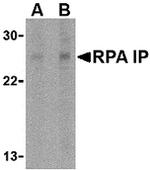 RPAIN Antibody in Western Blot (WB)