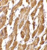 CRTH2 Antibody in Immunohistochemistry (IHC)