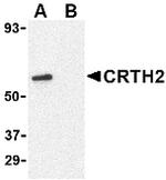 CRTH2 Antibody in Western Blot (WB)
