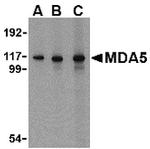 MDA5 Antibody in Western Blot (WB)