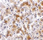 SCO2 Antibody in Immunohistochemistry (IHC)