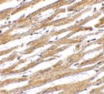 PD-L1 Antibody in Immunohistochemistry (Paraffin) (IHC (P))