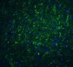 CD273 (B7-DC) Antibody in Immunohistochemistry (Paraffin) (IHC (P))