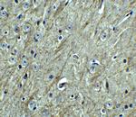 CD273 (B7-DC) Antibody in Immunohistochemistry (Paraffin) (IHC (P))