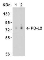 CD273 (B7-DC) Antibody in Western Blot (WB)