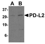 CD273 (B7-DC) Antibody in Western Blot (WB)