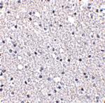 TIGAR Antibody in Immunohistochemistry (IHC)