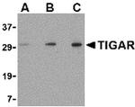 TIGAR Antibody in Western Blot (WB)