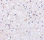 MAVS Antibody in Immunohistochemistry (IHC)