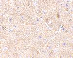 MAVS Antibody in Immunohistochemistry (IHC)