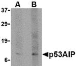 p53AIP1 Antibody in Western Blot (WB)