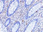 CD82 Antibody in Immunohistochemistry (IHC)