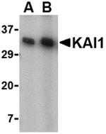 CD82 Antibody in Western Blot (WB)