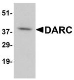 DARC Antibody in Western Blot (WB)