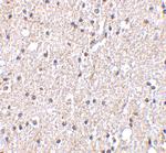 STK29 Antibody in Immunohistochemistry (IHC)