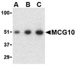 PCBP4 Antibody in Western Blot (WB)