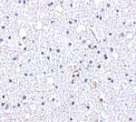 DARC Antibody in Immunohistochemistry (IHC)