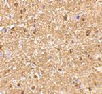 Nogo-A Antibody in Immunohistochemistry (IHC)