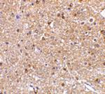 Nogo-A Antibody in Immunohistochemistry (IHC)