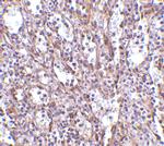 STIM1 Antibody in Immunohistochemistry (IHC)