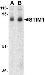 STIM1 Antibody in Western Blot (WB)