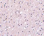 Presenilin 1 Antibody in Immunohistochemistry (IHC)