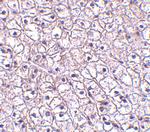 TSLP Receptor Antibody in Immunohistochemistry (IHC)