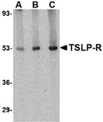 TSLP Receptor Antibody in Western Blot (WB)