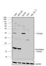 p16INK4a Antibody in Western Blot (WB)