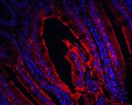 p16INK4a Antibody in Immunohistochemistry (PFA fixed) (IHC (PFA))