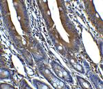 p16INK4a Antibody in Immunohistochemistry (Paraffin) (IHC (P))