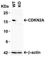 p16INK4a Antibody in Western Blot (WB)