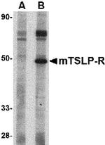 TSLP Receptor Antibody in Western Blot (WB)