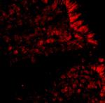 MICA Antibody in Immunohistochemistry (IHC)