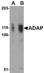 ADAP Antibody in Western Blot (WB)