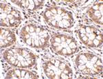 STEAP2 Antibody in Immunohistochemistry (IHC)