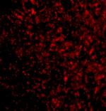 STEAP3 Antibody in Immunocytochemistry (ICC/IF)