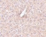 STEAP3 Antibody in Immunohistochemistry (IHC)