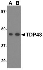 TDP-43 Antibody in Western Blot (WB)