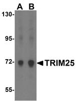 TRIM25 Antibody in Western Blot (WB)