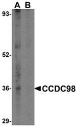 ABRA1 Antibody in Western Blot (WB)